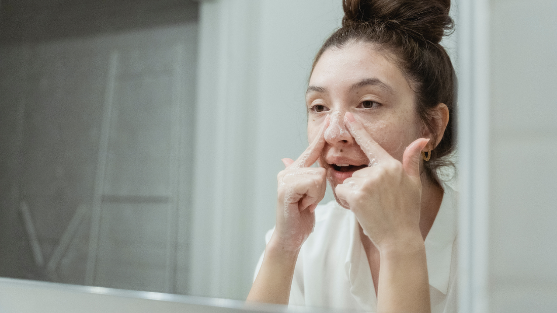 Why You Might Be Breaking Out After Washing Your Face