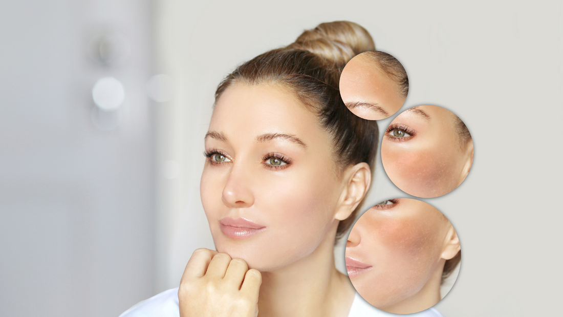 Can Toners Help Fade Dark Spots?