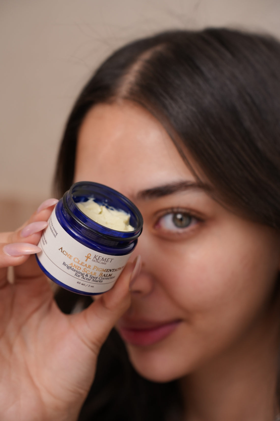 Acne is not a symptom of bad skin